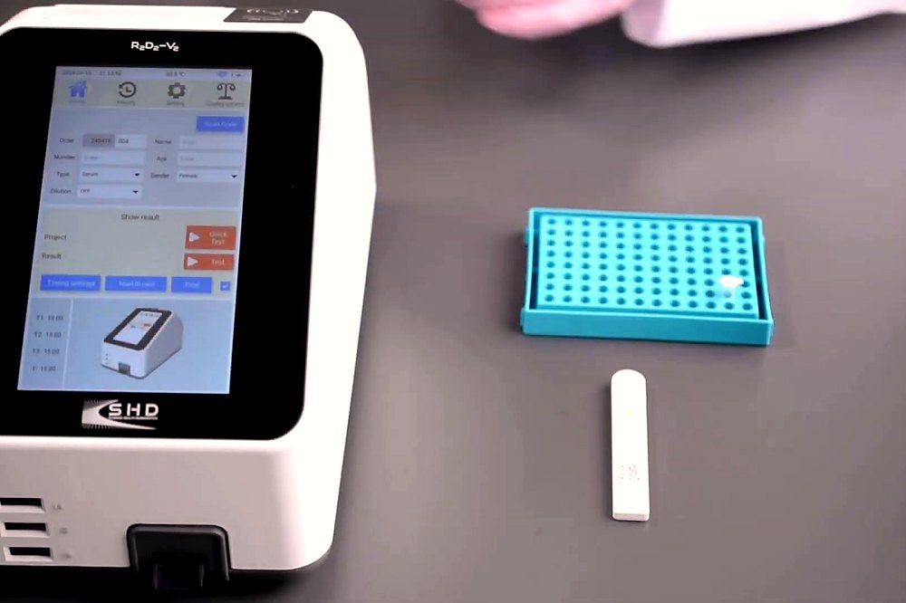 Point-of-care fluorescence testing